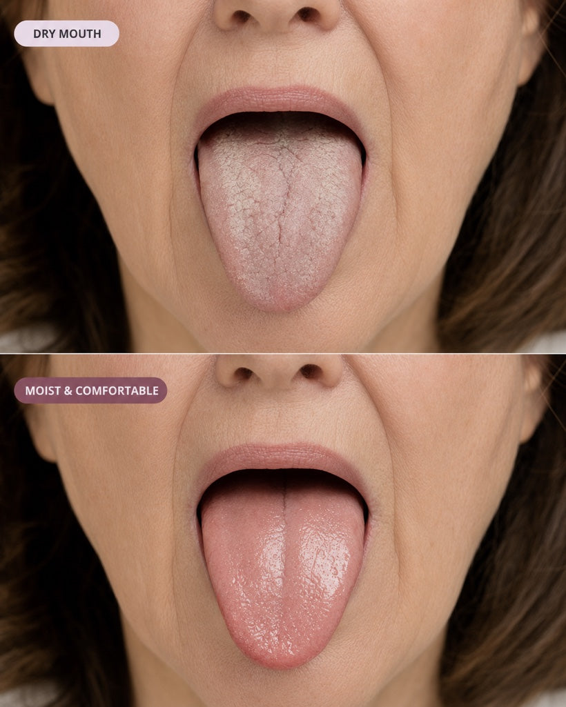 You wake up with a moist, comfortable mouth — from the very first night