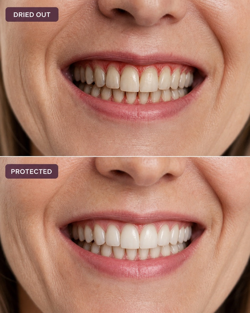 It helps protect your teeth and gums while you sleep