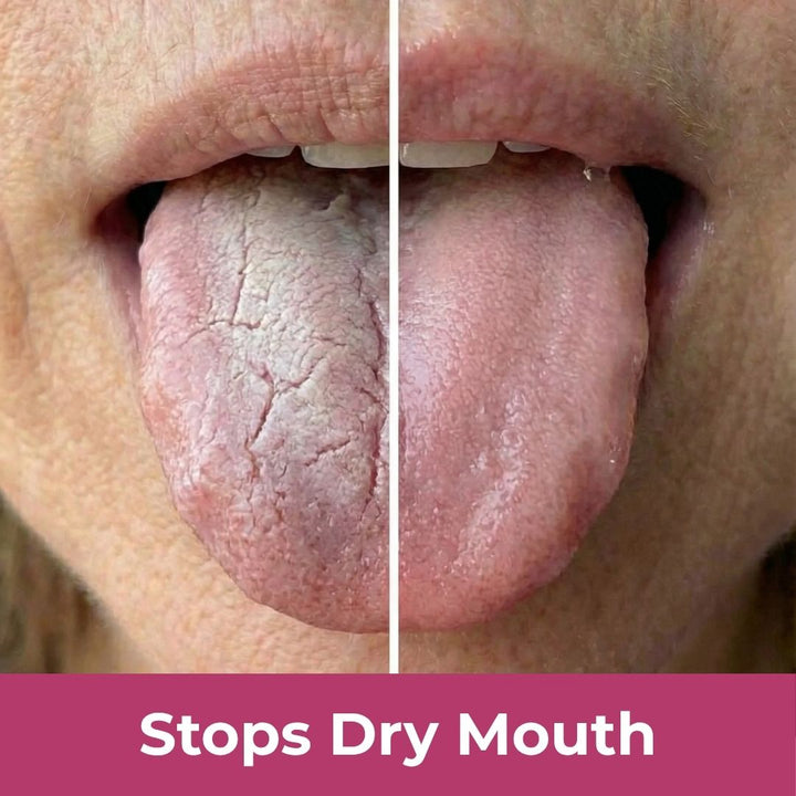 Ends Dry Mouth — And Protects Your Teeth