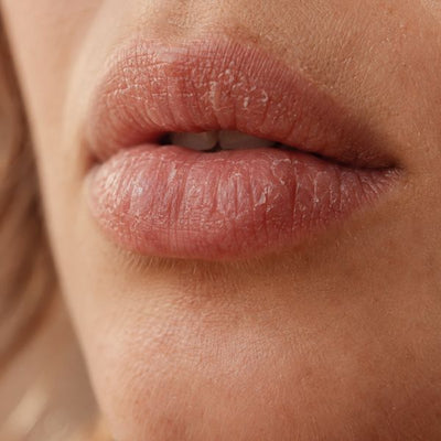Dry, flaky lips in the morning