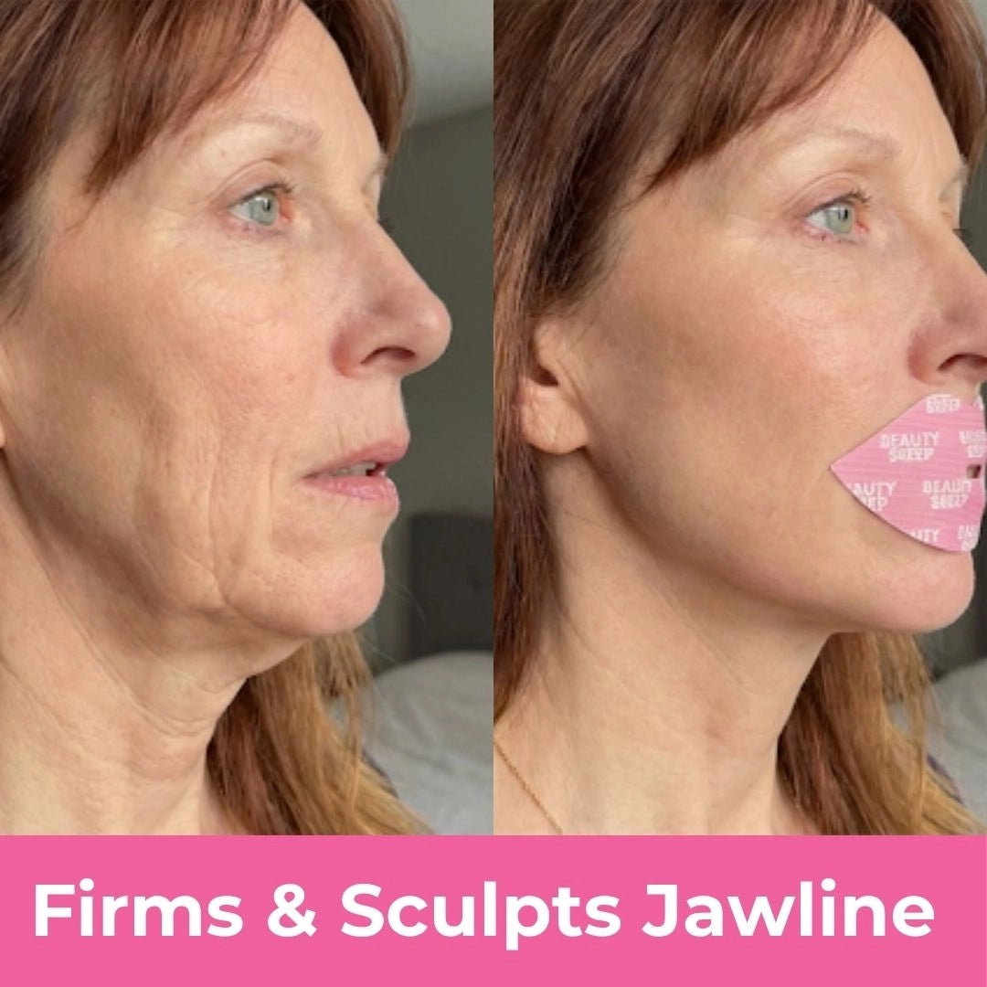 It Stops Your Jawline Sagging and Prevents Jowls and Deep Neck Wrinkles
