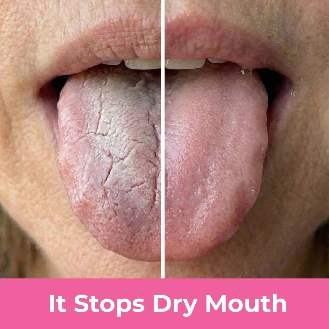 It Stops Dry Mouth and Keeps Your Teeth Protected All Night