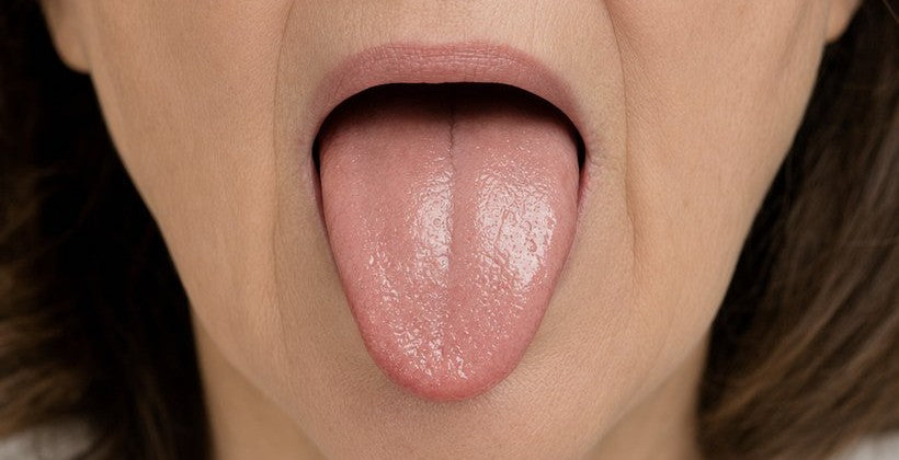 It Stops Dry Mouth and Bad Breath