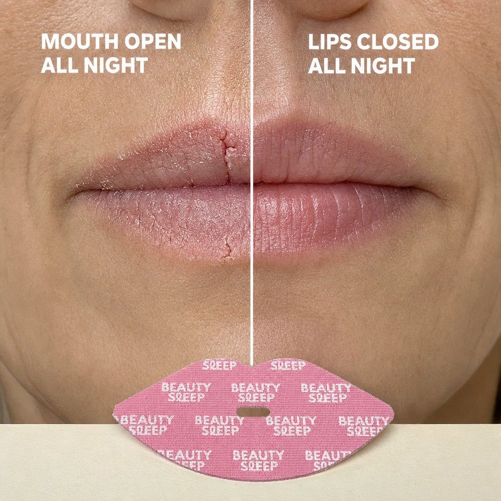 It Helps Stop Dry, Cracked Lips Overnight