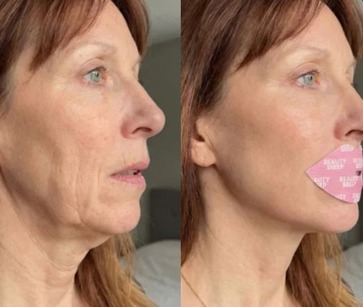Firms & Sculpts Jawline