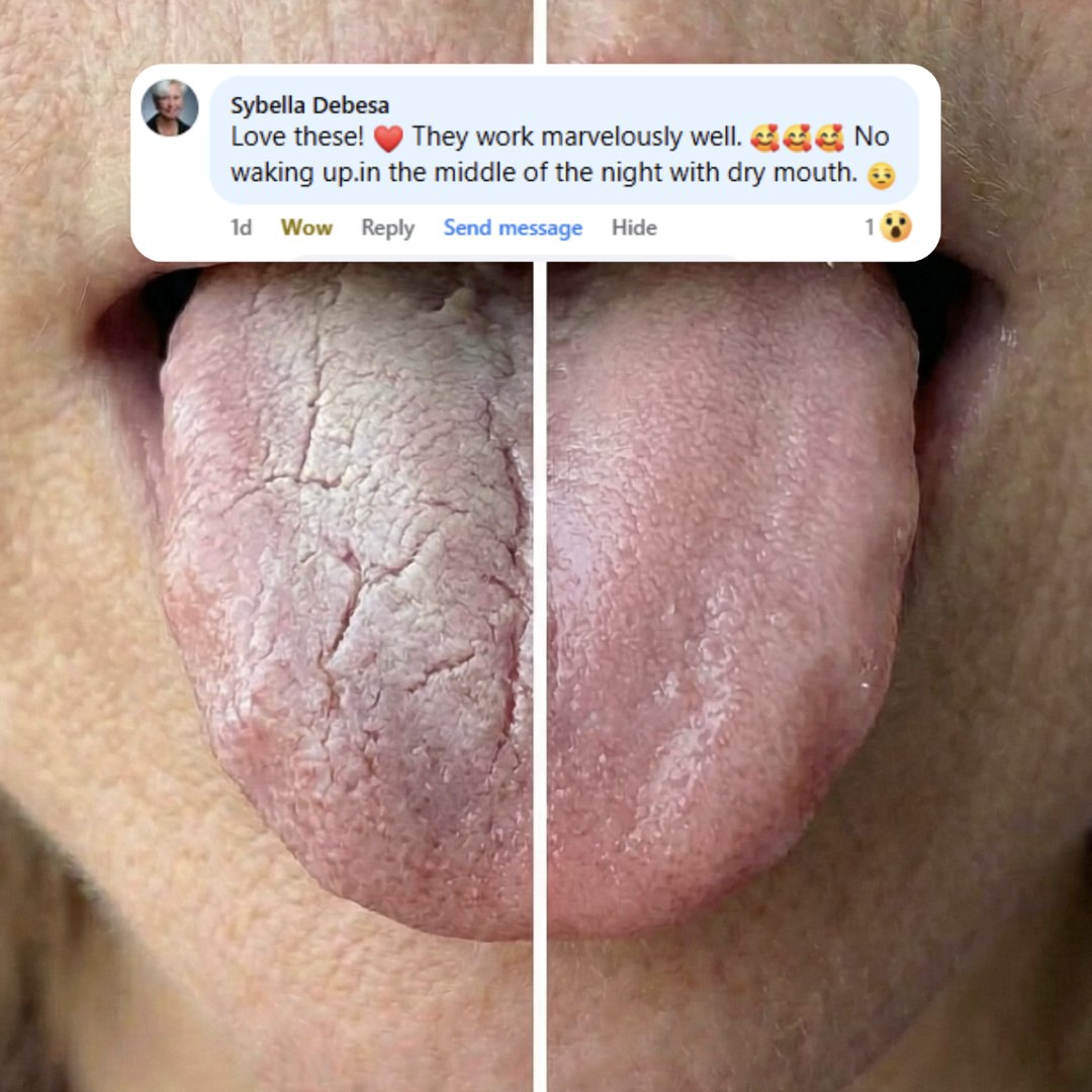 Helps You Wake Up Without Dry Mouth